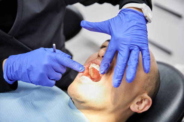 Best Emergency Treatment for Dental Infections or Abscesses in Telluride, CO