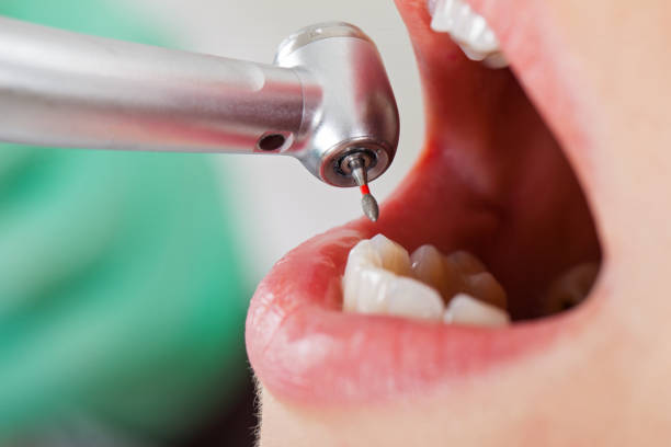 Best Emergency Treatment for Dental Infections or Abscesses in Telluride, CO